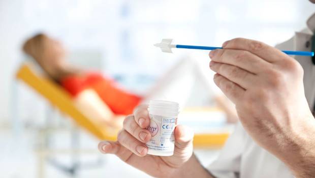 cancer09 نمونه برداری