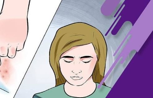 درمان تبخال تناسلی