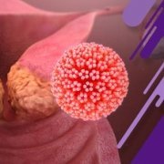 علائم ویروس HPV