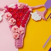 اندومتریوز