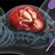 گره بند ناف جنین