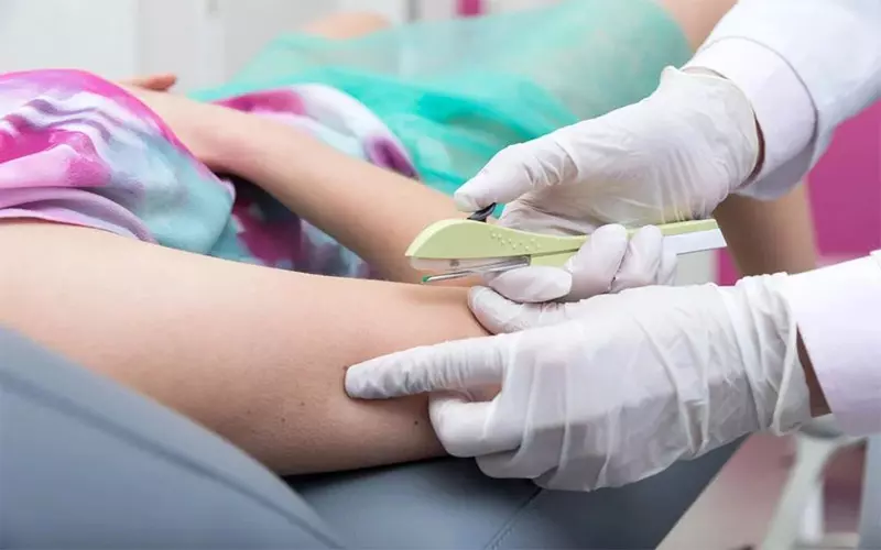 ایمپلنت‌های هورمونی پیشگیری از بارداری