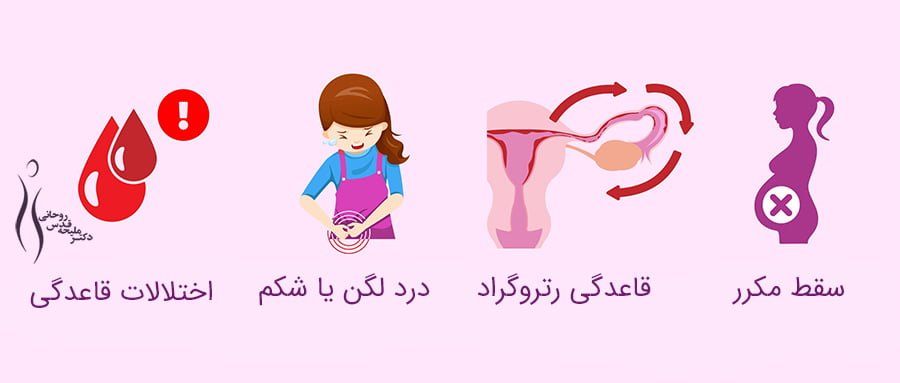 علائم چسبندگی رحم