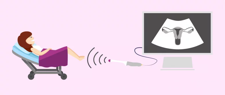 چسبندگی رحم