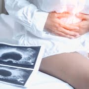 کیست تخمدان و بارداری