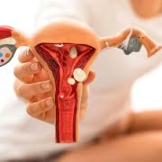 اندومتریوز