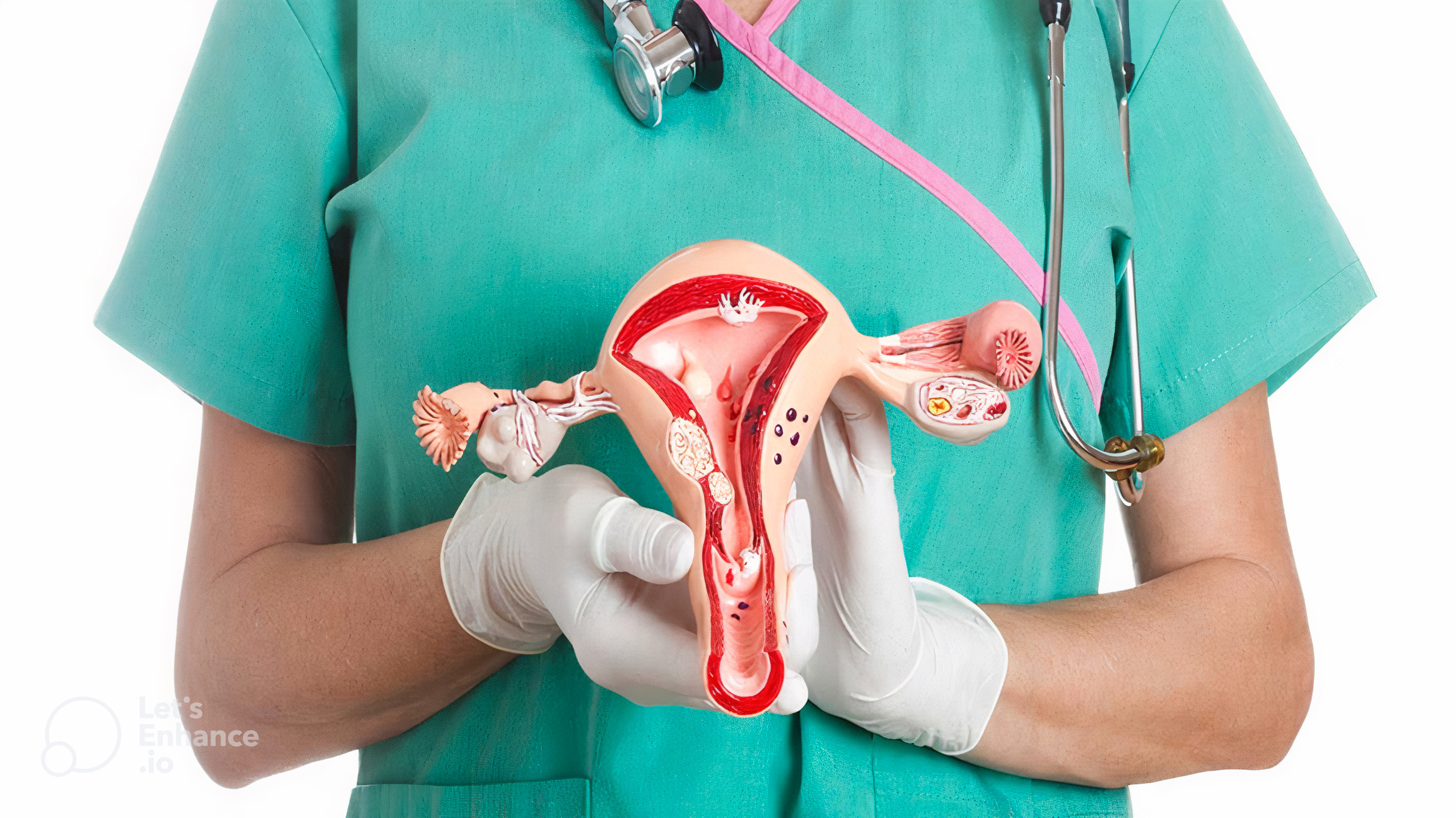 سرطان آندومتر