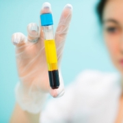 PRP واژن در کرج