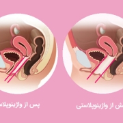 واژینوپلاستی در کرج دکتر ملیحه روحانی