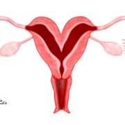 رحم دوتایی رحم دوگانه