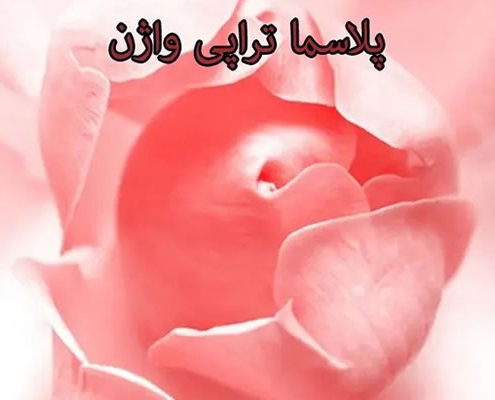 پلاسما تراپی وارنینال