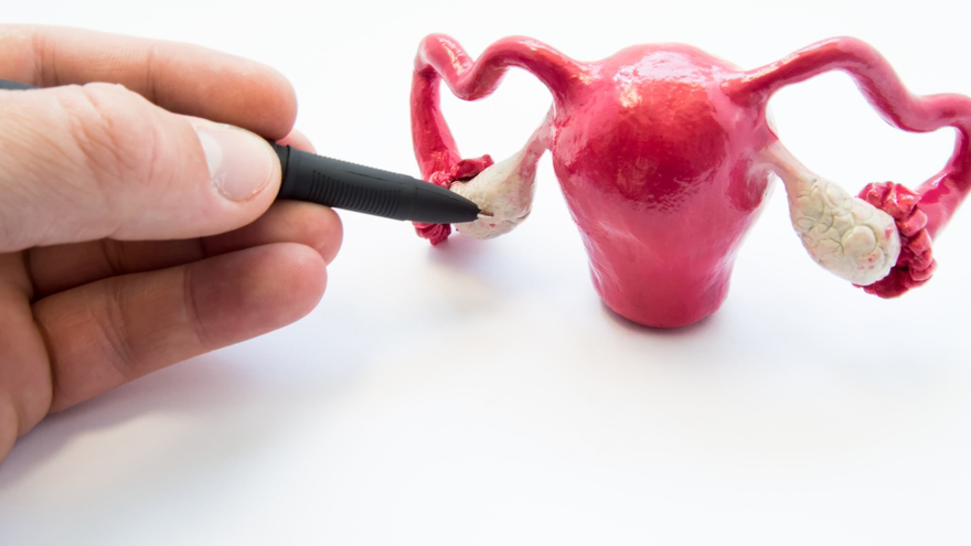 عدم تخمک گذاری