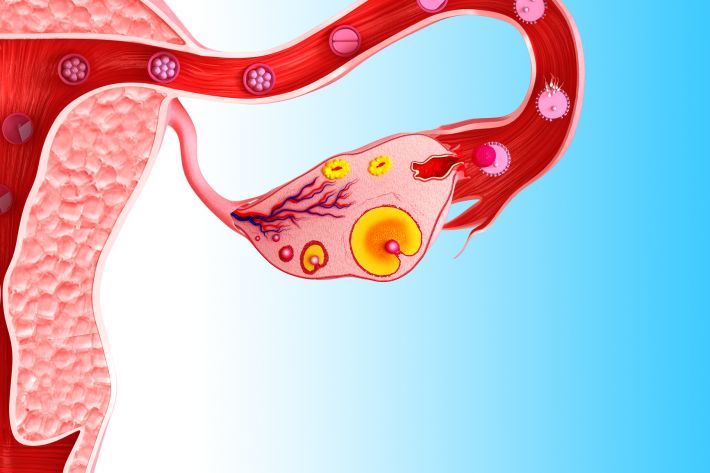 عدم تخمک گذاری