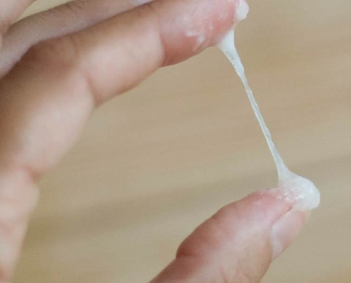 مخاط دهانه رحم