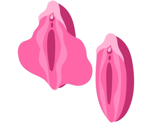 مزایای لابیاپلاستی با لیزر در کرج