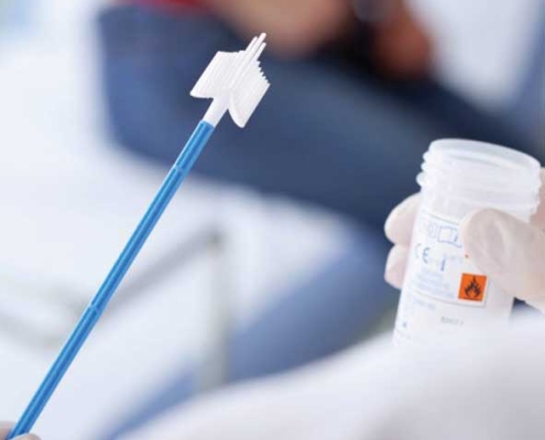 تست پاپ اسمیر